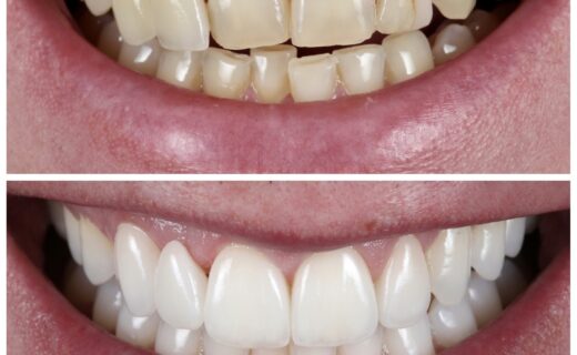 We’re back…Big dental procedures on the horizon…School holiday ends in 4 days…